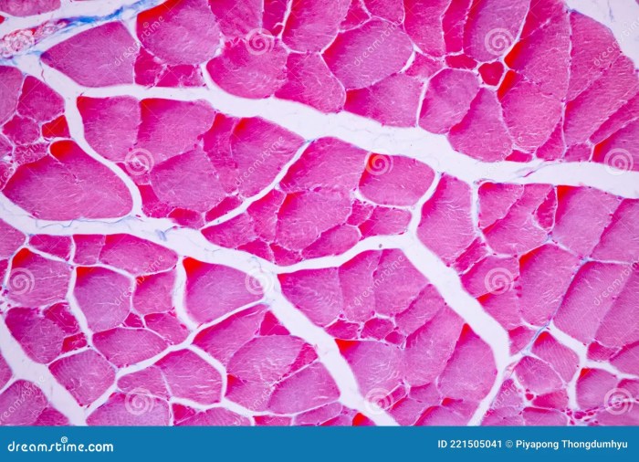 Skeletal muscle under microscope 400x